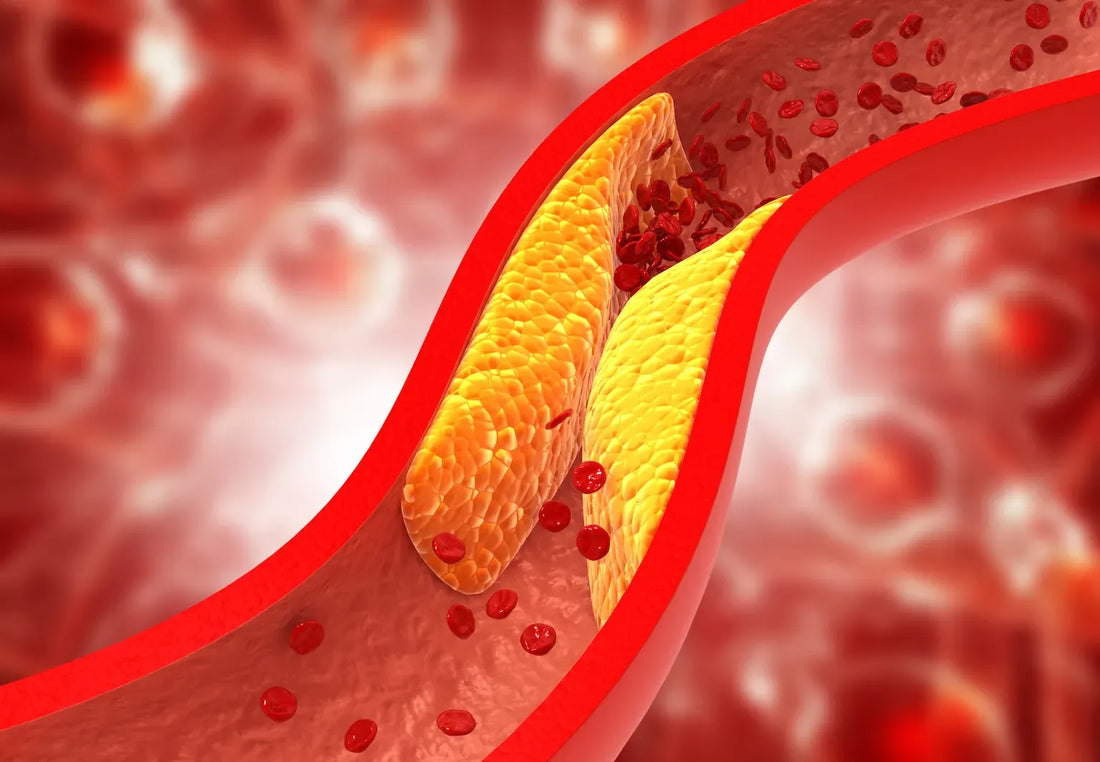 Why Ayurvedic Herbal Juices are the Best Natural Remedy for High Cholesterol